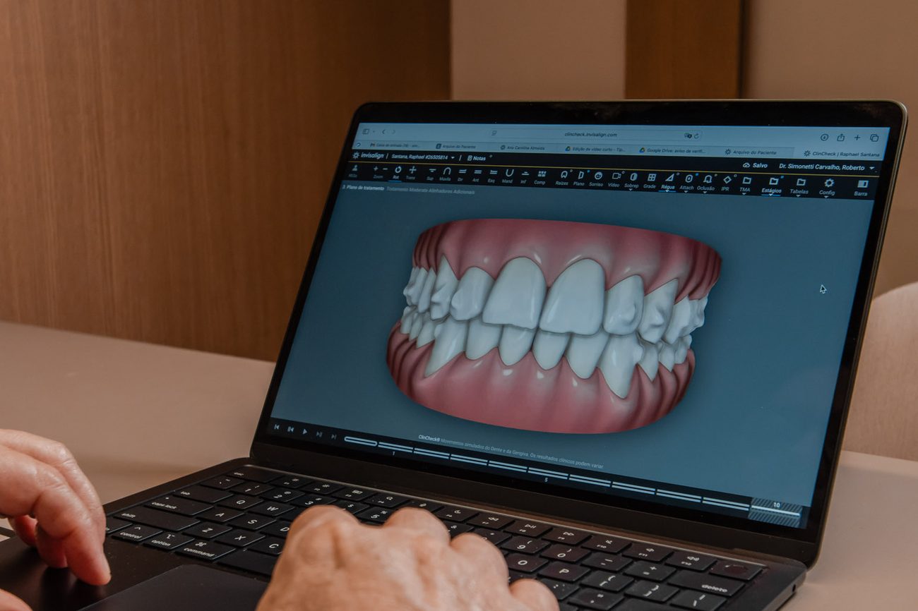 Planejamento digital do sorriso no computador